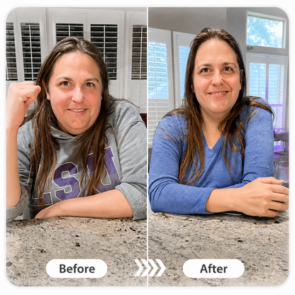 Doctor Recommended 🌟 | Kevrai® Berberine 10-in-1 Nano Microneedle Patch | ✅ Science-Backed Formula | 10-in-1 Advanced Blend | Visible Results in 7 Days 🏅