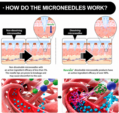 Doctor Recommended 🌟 | Kevrai® Berberine 10-in-1 Nano Microneedle Patch | ✅ Science-Backed Formula | 10-in-1 Advanced Blend | Visible Results in 7 Days 🏅