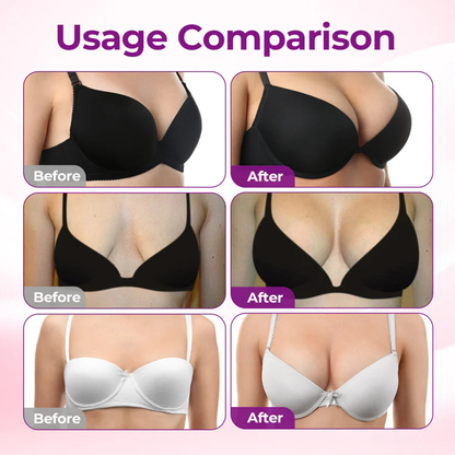 💥Turonu® 💗 Targeted Breast Enhancement Advanced Nano Microneedle Patch💃