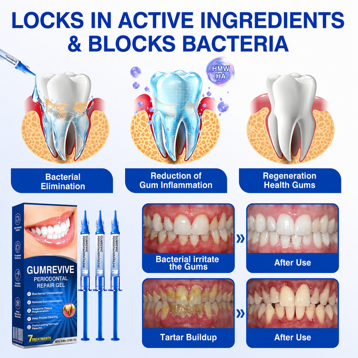 Periodontal Repair Gel*R