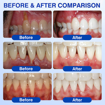 Periodontal Repair Gel*R
