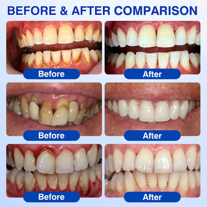 Periodontal Repair Gel*R