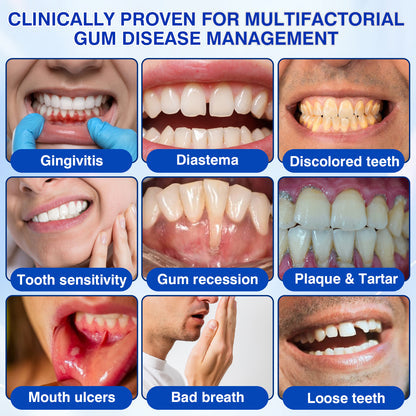 Periodontal Repair Gel*R